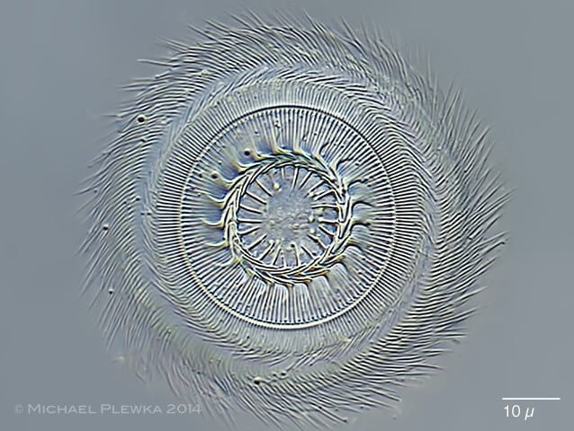 Trichodina